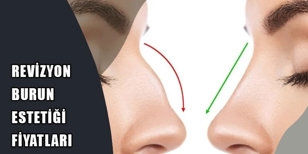 Burun Estetiği Fiyatları